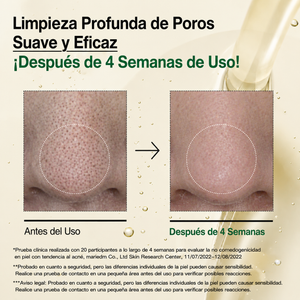 Óleo de Limpeza Facial Anua Heartleaf | Controle de Oleosidade