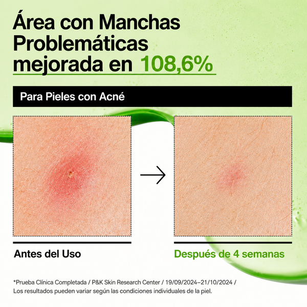 Sérum Ácido Hialurônico Anua Azelaico 10 | Pele Sensivel